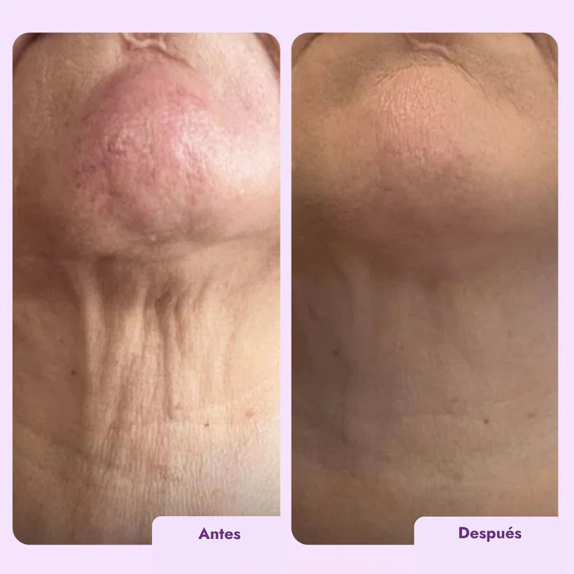 Crema Reafirmante Intensiva para Cuello y Escote ¡OFERTA 2x1!