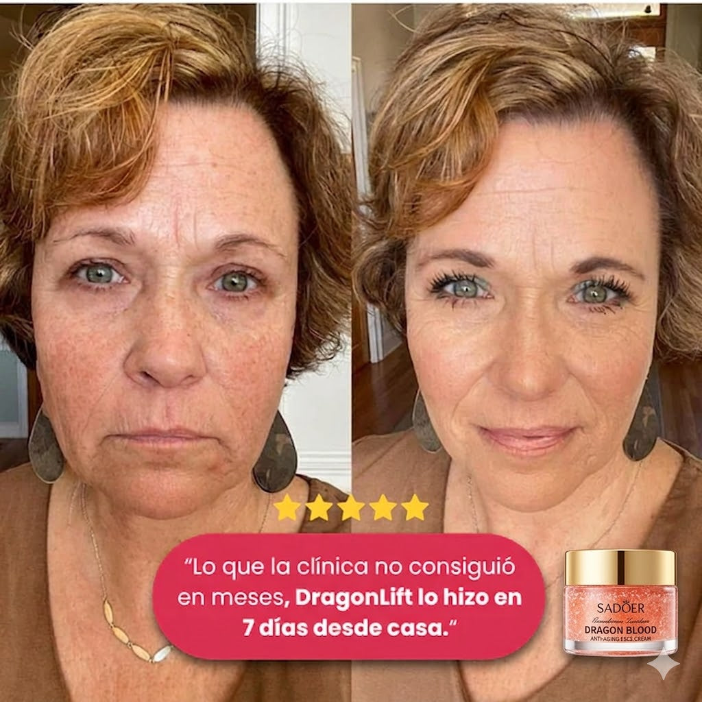 DILE ADIOS A LAS ARRUGAS✨ CREMA REJUVENECEDORA DRAGÓNLIFT– ¡OFERTA 2x1!