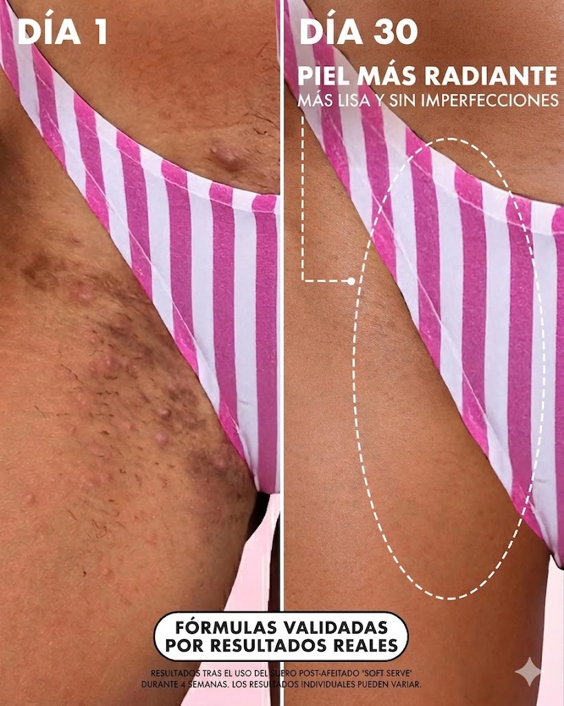 ¿Piel irritada y con granitos tras depilarte? Despídete del dolor con el Ritual Soft Serve: OFERTA ESPECIAL 2x1