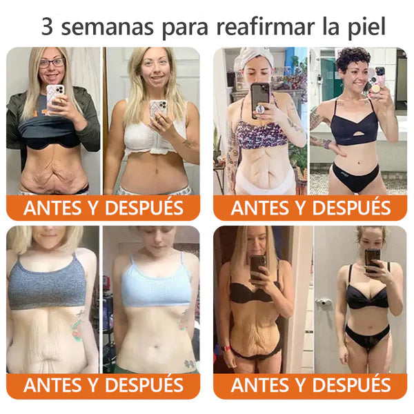 Crema con Veneno de Abeja Mejora tu Piel y Alivia el dolor en Articulaciones: ¡OFERTA 2x1!