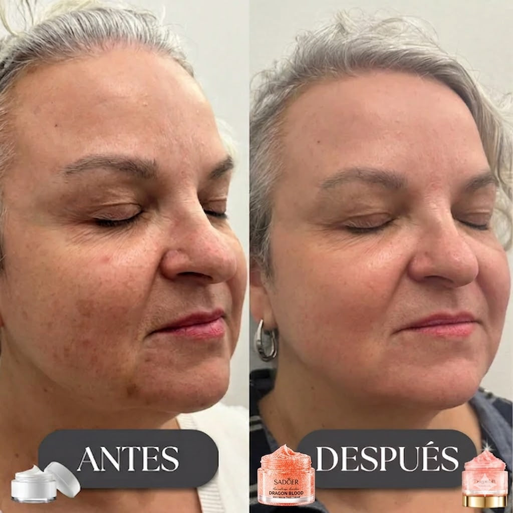 DILE ADIOS A LAS ARRUGAS✨ CREMA REJUVENECEDORA DRAGÓNLIFT– ¡OFERTA 2x1!