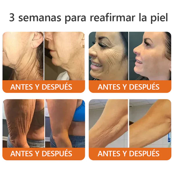 Crema con Veneno de Abeja Mejora tu Piel y Alivia el dolor en Articulaciones: ¡OFERTA 2x1!