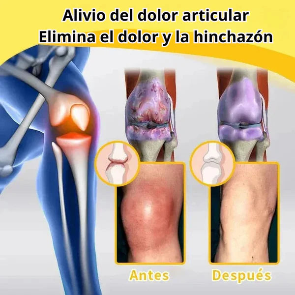 Crema con Veneno de Abeja Mejora tu Piel y Alivia el dolor en Articulaciones: ¡OFERTA 2x1!