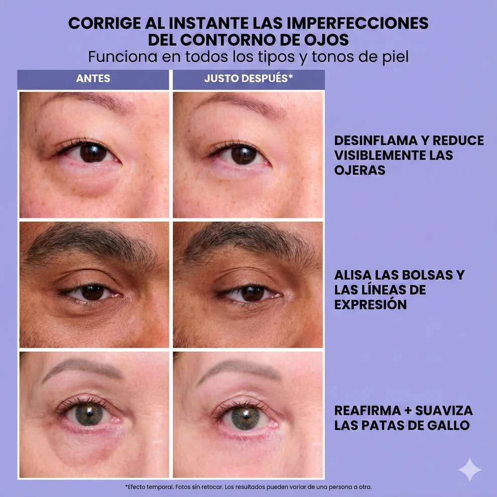 Reduce Bolsas, Arrugas y Ojeras – Efecto Lifting en Segundos ¡OFERTA ESPECIAL 2x1!