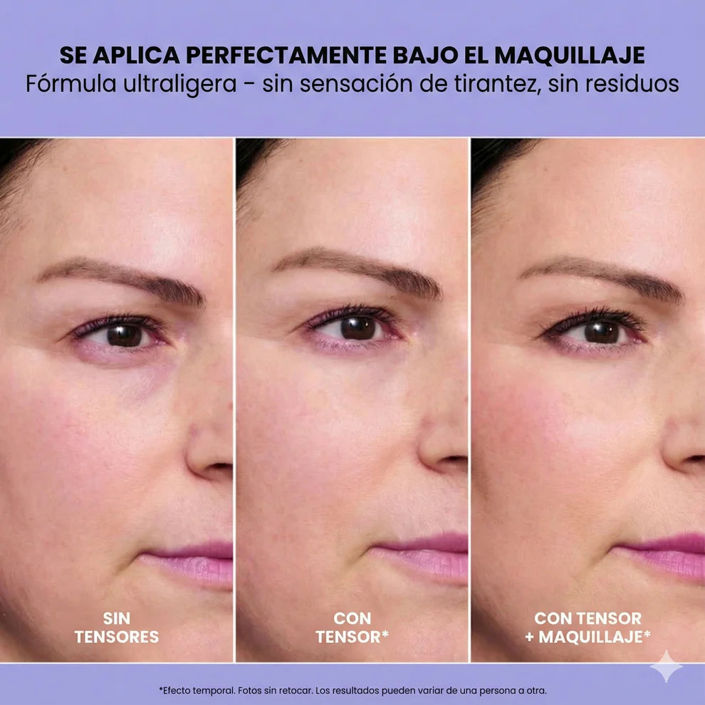 Reduce Bolsas, Arrugas y Ojeras – Efecto Lifting en Segundos ¡OFERTA ESPECIAL 2x1!