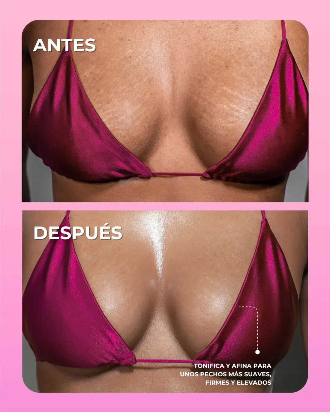 ¿Piel irritada y con granitos tras depilarte? Despídete del dolor con el Ritual Soft Serve: OFERTA ESPECIAL 2x1